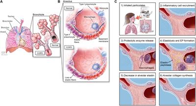 Nanotherapeutics to Modulate the Compromised Micro-Environment for Lung Cancers and Chronic Obstructive Pulmonary Disease